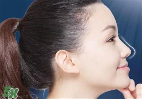 隆鼻會(huì)拉近眼距嗎？隆鼻會(huì)改變眼睛嗎？