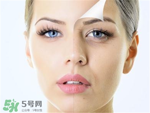 玻尿酸除皺有效果嗎？玻尿酸除皺效果怎么樣？