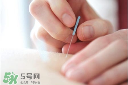 沒病可以針灸嗎？沒病可以扎針嗎？