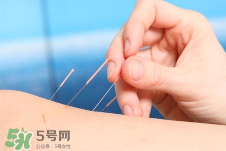 沒病可以針灸嗎？沒病可以扎針嗎？