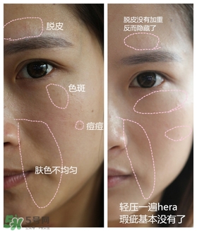 赫拉氣墊用了悶痘嗎？赫拉氣墊悶痘怎么辦？