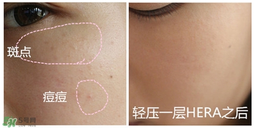 赫拉氣墊用了悶痘嗎？赫拉氣墊悶痘怎么辦？