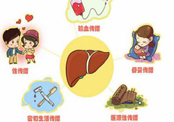 肝炎會(huì)傳染嗎？肝炎會(huì)不會(huì)傳染別人？