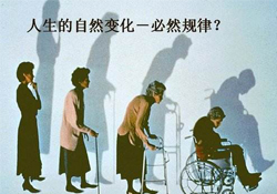 哪些人容易得骨質疏松癥？骨質疏松的高發(fā)人群有哪些？