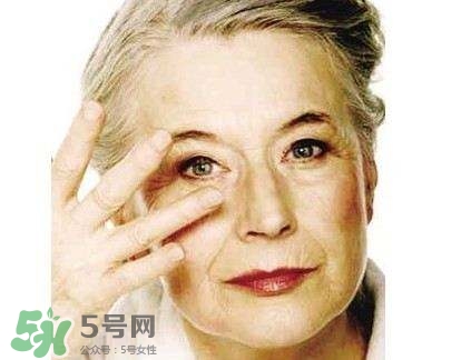 老年斑是怎么形成的？老年斑的形成原因
