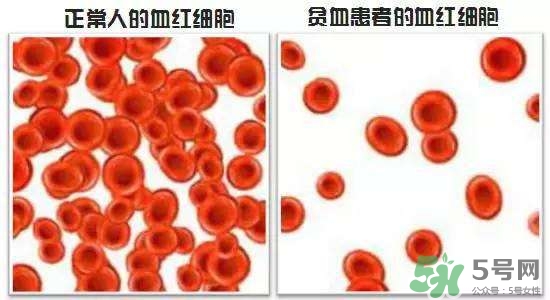 缺鐵性貧血的癥狀 缺鐵性貧血的癥狀有哪些？