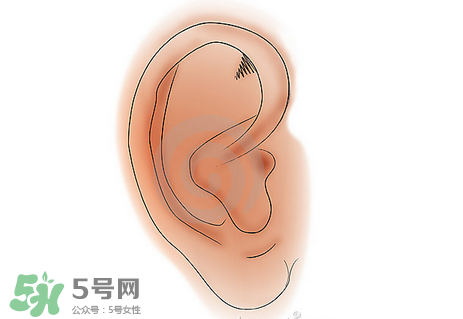 中耳炎有什么癥狀？中耳炎的癥狀表現(xiàn)