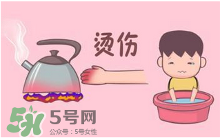燙傷可以用牙膏嗎？燙傷用牙膏管用嗎？