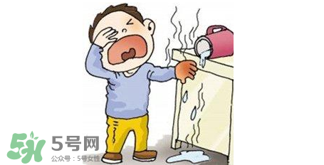 燙傷可以用牙膏嗎？燙傷用牙膏管用嗎？