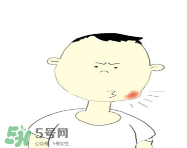 嘴角起泡是什么原因？嘴角起泡怎么辦？