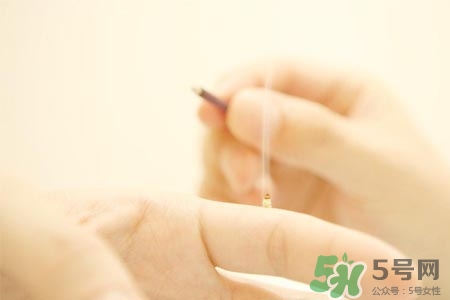 艾灸可以減肥嗎？艾灸減肥的穴位方法介紹