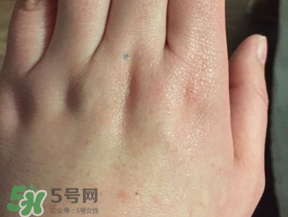 薇諾娜適合什么皮膚？薇諾娜適合敏感肌嗎？