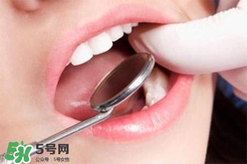口腔異味是怎么回事？口腔異味怎么清除？