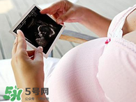 保胎期間可以洗澡嗎？臥床保胎可以洗澡嗎？
