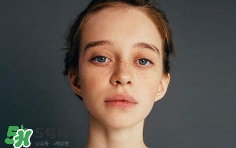 長(zhǎng)斑是什么原因引起的？祛斑效果最好的方法