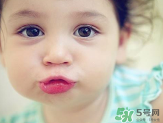 孕期可以激光祛斑嗎？懷孕了能做激光祛斑嗎？