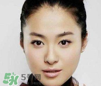 如何預(yù)防臉上長(zhǎng)痣？怎樣預(yù)防臉上長(zhǎng)痣