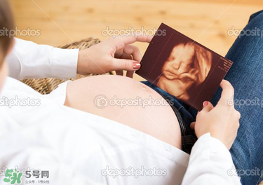 橄欖油真的可以預(yù)防妊娠紋嗎？橄欖油真的可以去妊娠紋嗎？