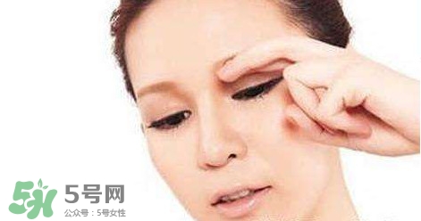 怎樣祛除眼底細(xì)紋？如何去除眼底細(xì)紋