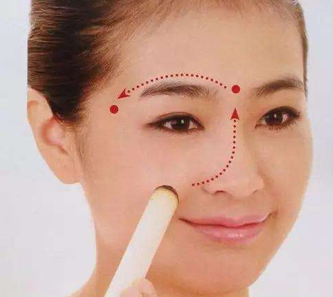 艾灸可以去黑眼圈嗎？艾灸可不可以去黑眼圈