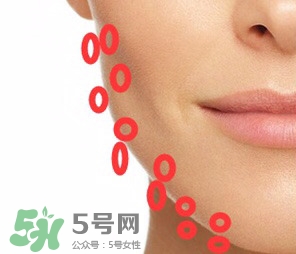 nuface美容儀有效嗎？nuface美容儀副作用？