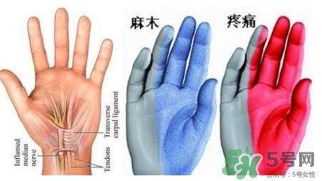 手腳發(fā)麻是缺鈣嗎？手腳發(fā)麻是不是缺鈣