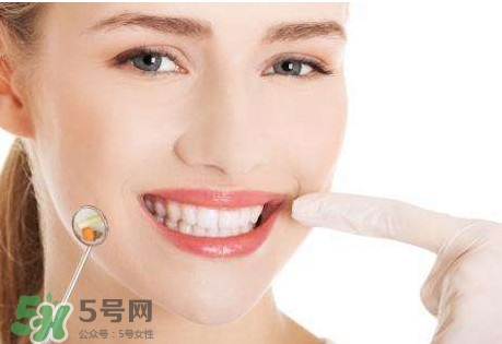 牙結(jié)石是什么？牙結(jié)石圖片