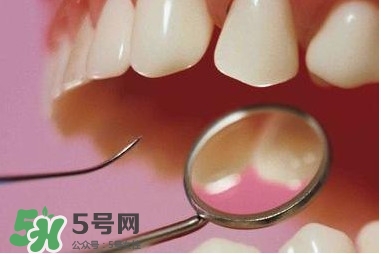 牙周炎傳染嗎？牙周炎會(huì)不會(huì)傳染