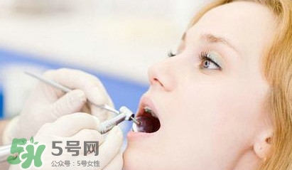 牙齒松動能自己恢復嗎？牙齒松動會自己恢復嗎