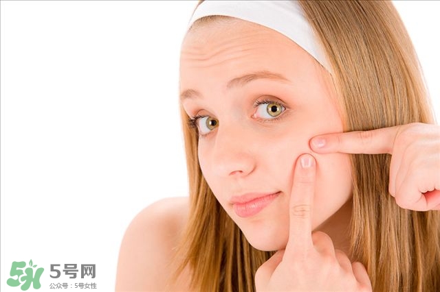 得了痤瘡飲食注意什么？有痤瘡吃東西注意什么