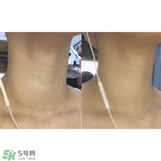 悅薇適合什么年齡？資生堂悅薇適合年齡段