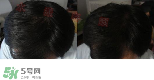 資生堂不老林洗發(fā)水怎么樣？資生堂不老林洗發(fā)水能長頭發(fā)嗎