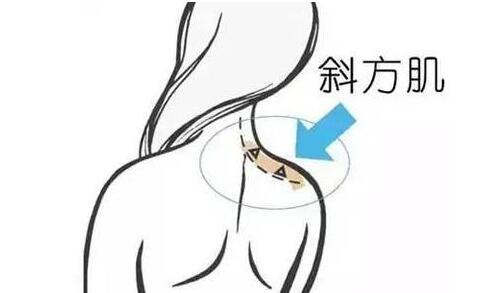 天鵝頸是什么樣的？天鵝頸怎么練？