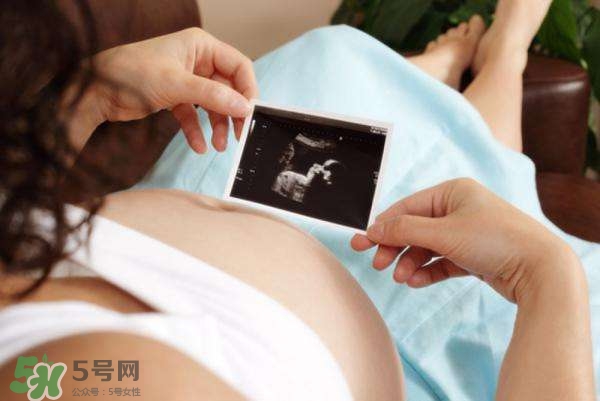 四維彩超能看出男女嗎？四維彩超能看清手指嗎？