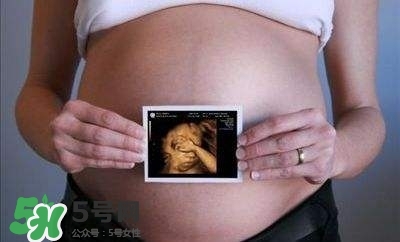 四維彩超能看出男女嗎？四維彩超能看清手指嗎？
