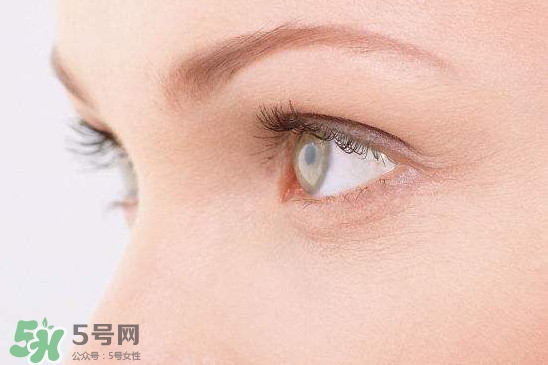 眼睛布滿血絲怎么回事？眼睛布滿血絲怎么辦