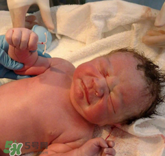 新生兒手握避孕環(huán)出生是怎么回事？出生后健康嗎？