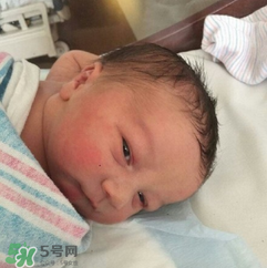 新生兒手握避孕環(huán)出生是怎么回事？出生后健康嗎？