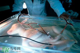 人造子宮能生孩子嗎？人造子宮成功案例