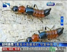 隱翅蟲有毒嗎？隱翅蟲會(huì)毀容嗎？