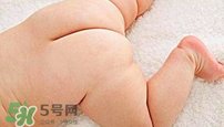 尿布疹怎么辦？寶寶尿布疹擦什么藥好？