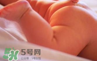 寶寶尿布疹可以擦紅霉素軟膏嗎？紅霉素軟膏對(duì)尿布疹有效嗎？