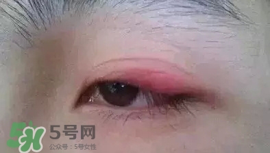 長期用假睫毛雙眼皮貼對眼睛有什么傷害？