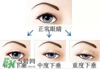 長期用假睫毛雙眼皮貼對眼睛有什么傷害？