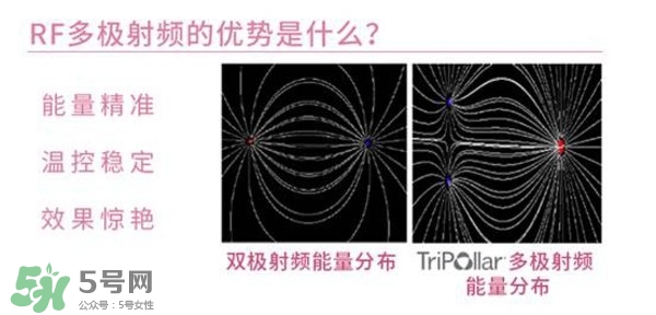 tripollar stop怎么樣？tripollar pose好用嗎
