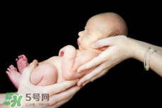 寶寶臍帶掉了要緊嗎？寶寶臍帶掉了出血了怎么辦？
