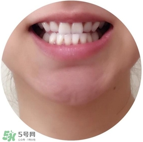 牙齒黃用什么洗能白 用什么洗牙齒會(huì)變白