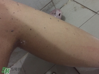shills舒兒絲去角質(zhì)雪泡怎么用？shills舒兒絲去角質(zhì)雪泡用法