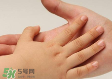 寶寶指甲凹凸不平是什么原因？寶寶指甲凹凸不平正常嗎？