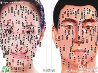 藥水點痣和激光點痣哪個好？各有什么優(yōu)缺點